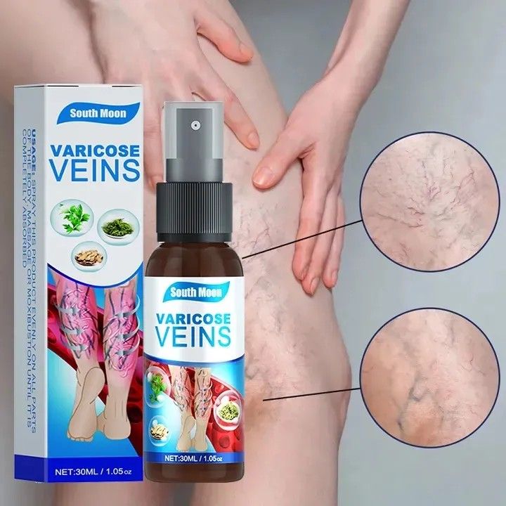 Varicose Veins Relief Spray – Herbal Treatment for Spider &amp; Varicose Veins (30ml)